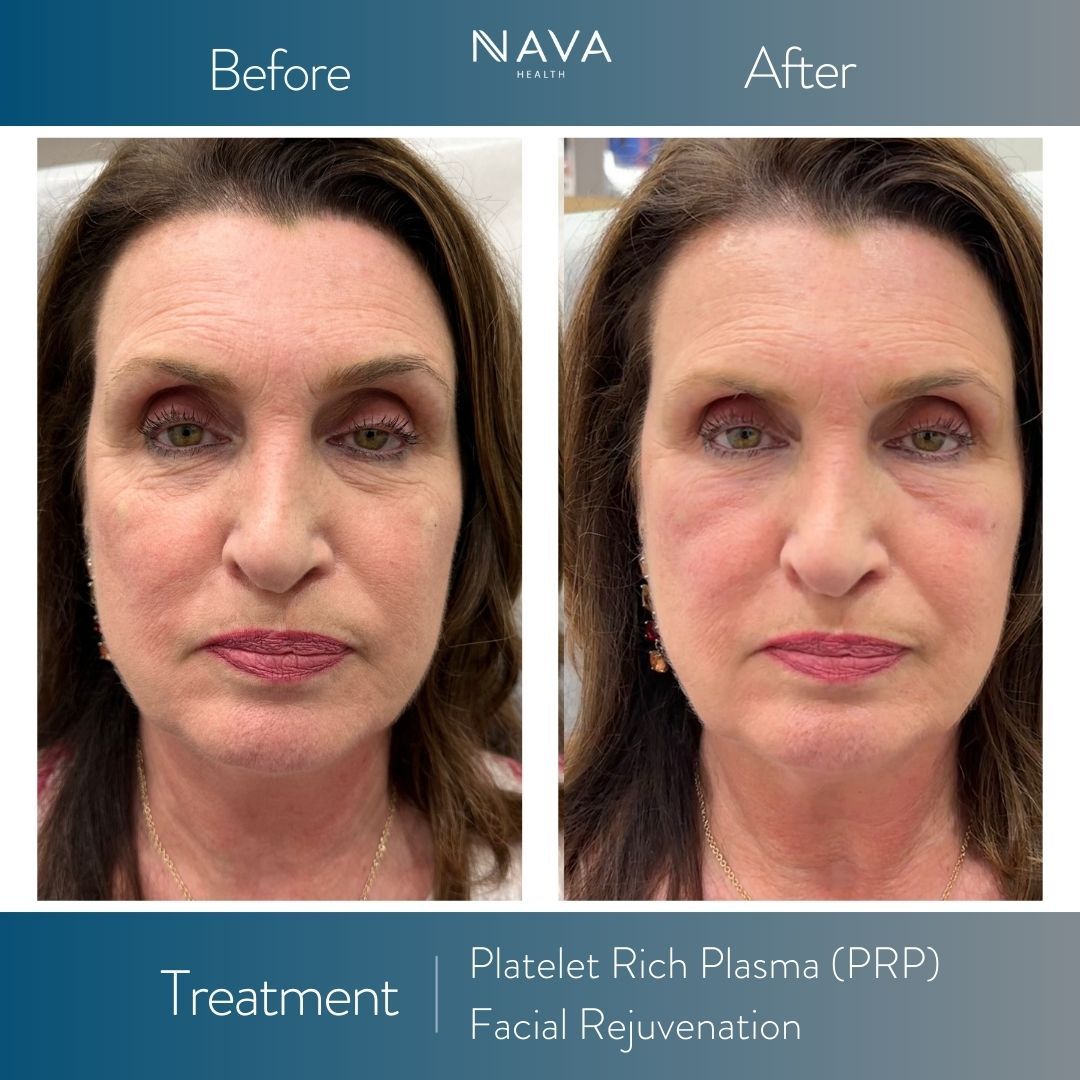 Navacenter – Bethesda - Image 6