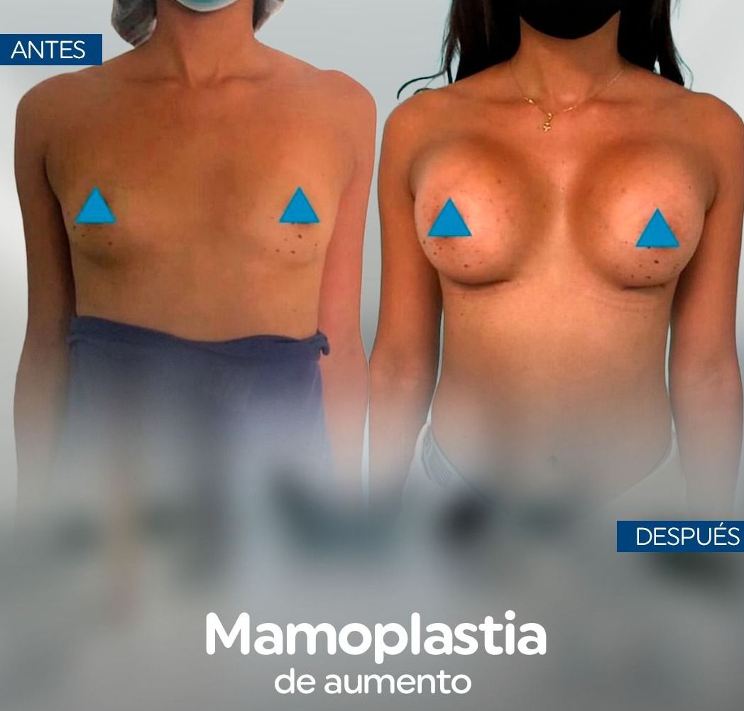 Dr. Alvaro Uribe - Image 1