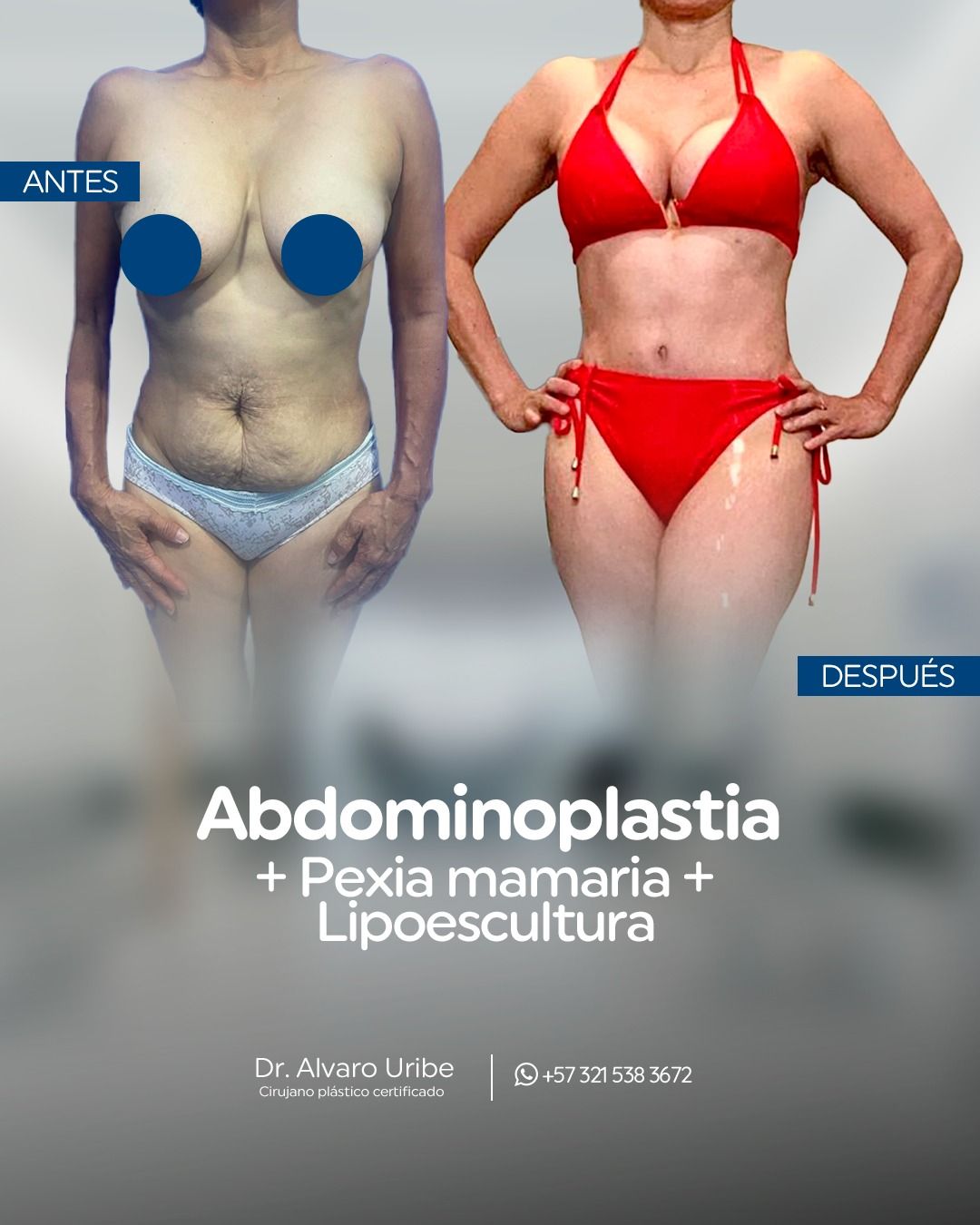 Dr. Alvaro Uribe - Image 6