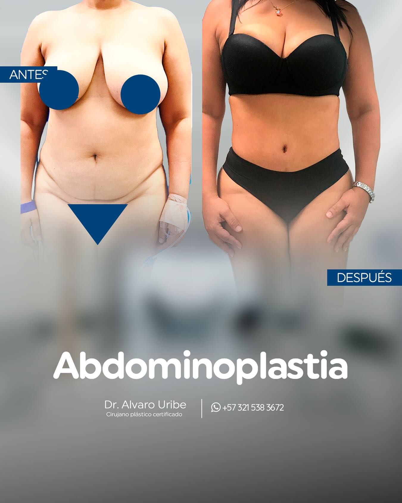 Dr. Alvaro Uribe - Image 4