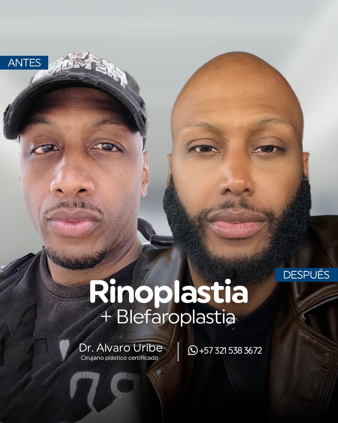 Dr. Alvaro Uribe - Image 10