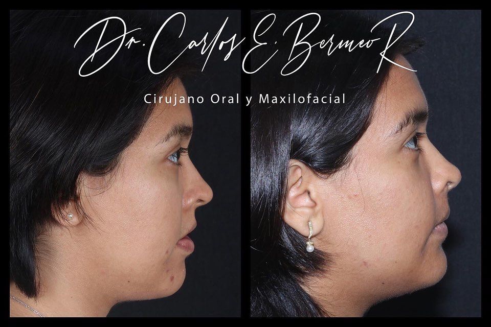 Dr. Carlos Bermeo - Image 2