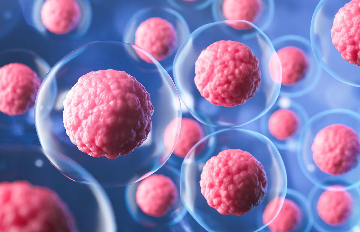 Breakthrough in Juvenile Systemic Sclerosis: The Impact of Stem Cell Transplants